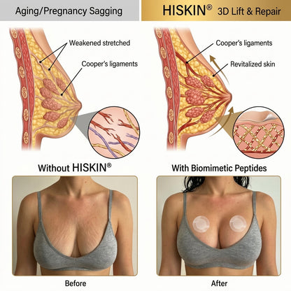 🏆 HISKIN® ✨ Breast Volume Boost & Firming Nano Microneedle Patches 🎀 Lift sagging, restore fullness—no surgery, no injections, zero irritation.